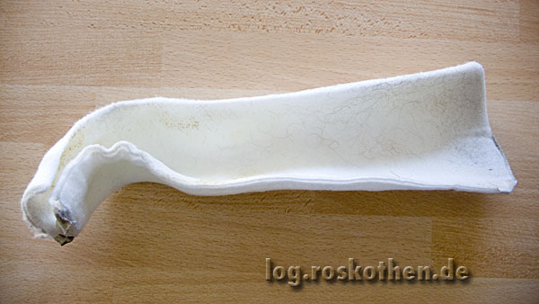 Fiberglasschiene für den gebrochenen Mittelhandknochen